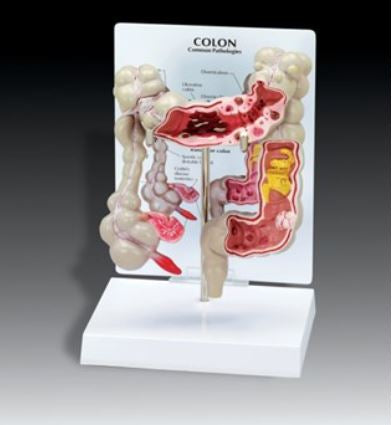 Anatomical Chart Company Colon Model - G334