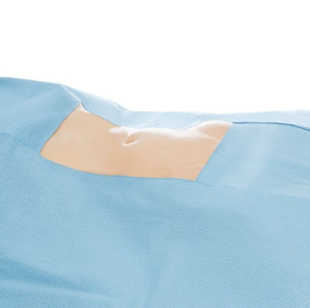 O&M Halyard - Surgical Drape Bottom Drape 76 W X 76 L Inch NonSterile - 79561