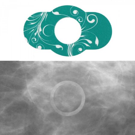 Spee-D-Line Swirl Collection - Mammography Mole Marker 1/2 Inch Inner Diameter - SDG-MSD3