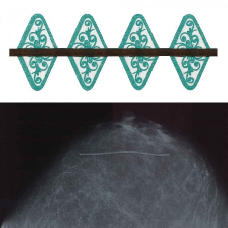 Spee-D-Line Swirl Collection - Mammography Scar Marker 1.0 mm Line - SDW-SSD3