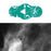 Spee-D-Angle - Mammography Skin Marker - SDM-TSD3