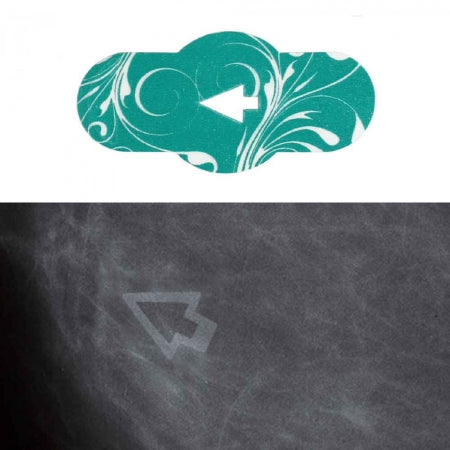 Spee-D-Mark - Mammography Skin Marker - SDM-ASD3
