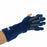 Benik W-710 - Forearm Based CVA/TBI Splint - 566455