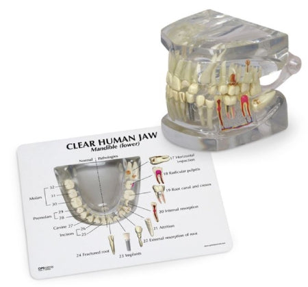 Nasco Galloway Plastics Clear Human Jaw with Teeth - SB48717