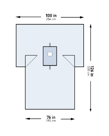 McKesson McKesson Surgical Drape Breast Drape 100 W X 76 W X 126 L Inch Sterile - 183-I80-05214G-S