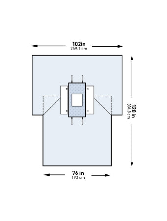 McKesson McKesson Abdominal Drape Laparotomy Drape 102 W X 76 W X 120 L Inch Sterile - 183-I80-05170G-S