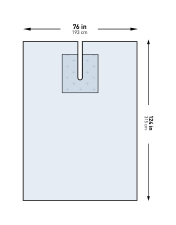 McKesson McKesson EENT Drape EENT Split Drape 76 W X 124 L Inch Sterile - 183-I80-09143G-S