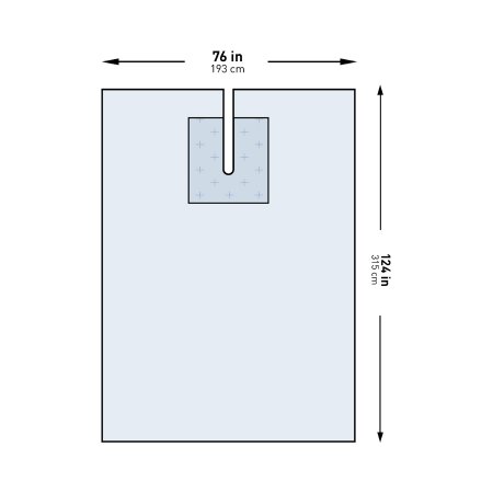 McKesson - EENT Drape EENT Split Drape 76 W X 124 L Inch Sterile - 183-I80-09143G-S