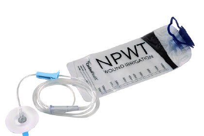 Cardinal Health - Irrigation Delivery Kit - 47-6500