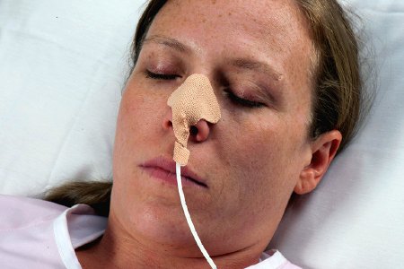 Dale Medical Products - Nasogastric Tube Holder Small - 161