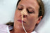 Dale Medical Products Nasogastric Tube Holder Small - 161