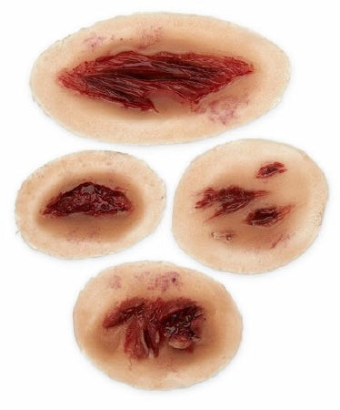 Nasco MST Laceration Wound Model Kit Silicone Rubber - SB50199