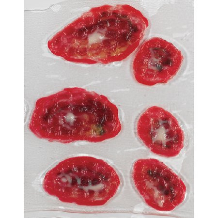 Life/Form - Wound Makeup Venous Stasis Ulcer - LF00792