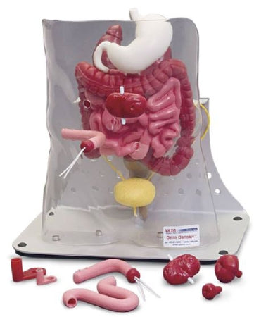 Nasco Complete Otto Ostomy Package Ostomy Model 12 lbs. - SB48421