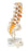 Fabrication Enterprises 3B Anatomical Model Prolapsed Lumbar Section 3 lbs. - 965672