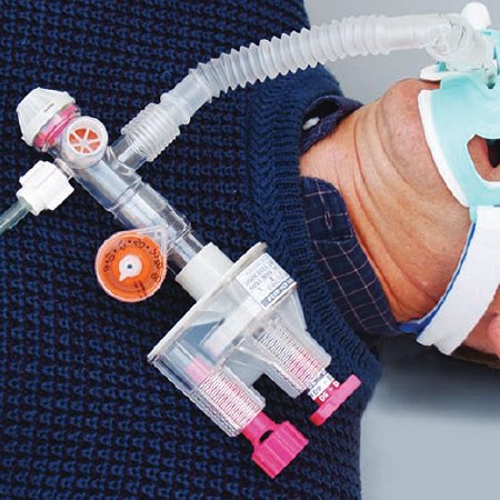 Surevent - Transport Ventilator Automatic - SV2131B