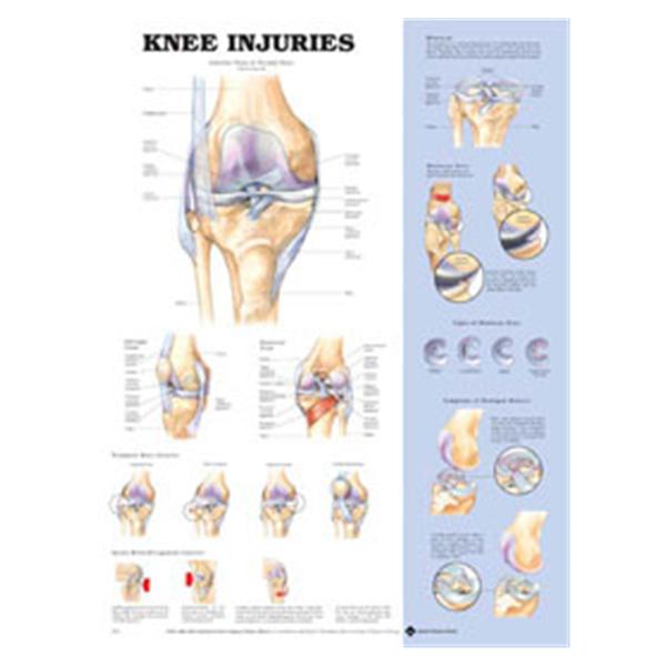 Wolters Kluwer Health Inc Chart Anatomical Knee Injuries 20X26" Ea - 9781587797576