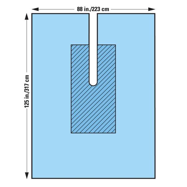 O & M Halyard Drape Orthopedic Orthopedic Fenestrated 88X125" Large Sterile 11/Ca - 89311
