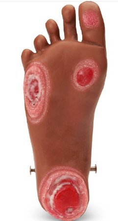 Life/form GERi and KERi Optional Pressure Injury Foot - Foot Wound Care Model 2-1/2 lbs. - LF04128