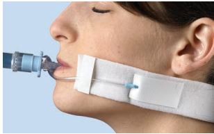 Cooper Surgical - Endotracheal Tube Holder Disposable Tapeless - 42-1820