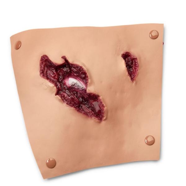 Nasco Company Moulage Training Compound Fracture Femur Upper Leg Ea - 800-6819