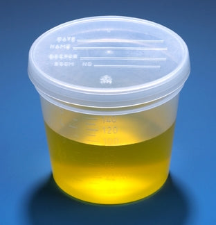 Globe Scientific CONTAINER, SPECIMEN PP GRAD 5OZ W/SEPARATE CAP (300/CS) - 5917