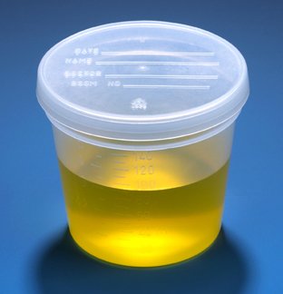 Globe Scientific - Specimen Container 2-1/4 X 2-7/8 Inch 150 mL (5 oz.) Snap-On Lid Patient Information NonSterile - 5917