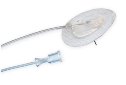 Intra Pump Infusion Systems Infusion Set, Neria Sub-Q 29Gx6Mm 42" Tube (10/Bx) - PP1102936N