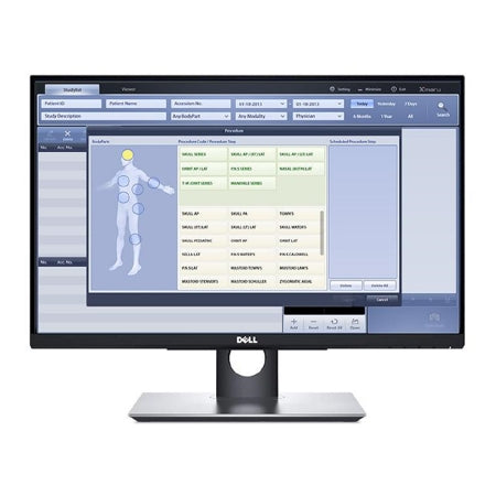 Rayence Imaging Monitor Touch Screen For Use With X-Ray System - V0800013