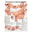 Wolters Kluwer Health Inc Chart Educational Understanding Colorectal Cancer 20X26" Ea - 9780781773331