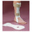 Patterson Medical Splint Orthosis Anterior Afo Men 7-9/Women 5-10 Ft/Lg M7-9/W5-10 Wht Sz Sm/Md Ea - A156100