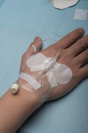 Dale Medical Products Device, Securement Cath Iv Arterial & Mid-Line (50/Bx) - 850