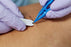 Florida Medical Sales Suture Removal Kit - CHS85-4337