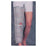 DJO Immobilizer Post-Op Adult Knee Beige Size One Size Fits All Universal Ea - 11-0237-9