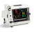 Auxo Medical Refurbished Vital Signs Monitor Patient Vital Signs Monitoring Type Nibp, Spo2, Tempeture Battery - AM-SURESIGN-VS4