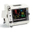 Auxo Medical - Refurbished Vital Signs Monitor Vital Signs Monitoring Type NIBP, SpO2, Tempeture Battery Operated - AM-SURESIGN-VS4