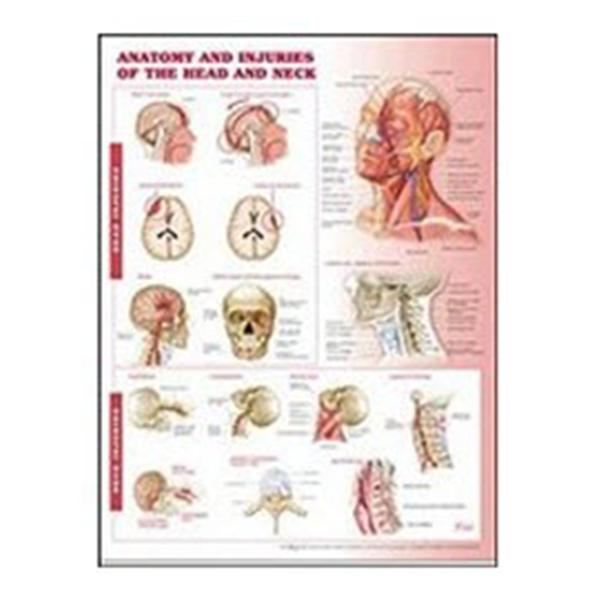 Lippincott Williams @ Wilkins Chart Anatomical Anatomy And Injuries Of The Head And Neck 20X26" Ea - 9780781786713