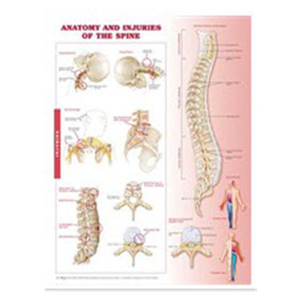 Lippincott Williams @ Wilkins Chart Anatomical Anatomy And Injuries Of The Spine 20X26" Ea - 9780781786676