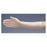 Patterson Medical Glove Edema Hand Hatch Beige Size 8" Small Left Ea - A571203