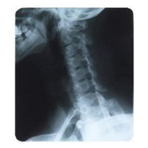 Agfa Corporation Film X-Ray 14X36" 100/Bx - EKYGK