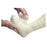 BSN Medical Off Loader Cutimed Tcc Plaster/Synthetic Ea - 7800900