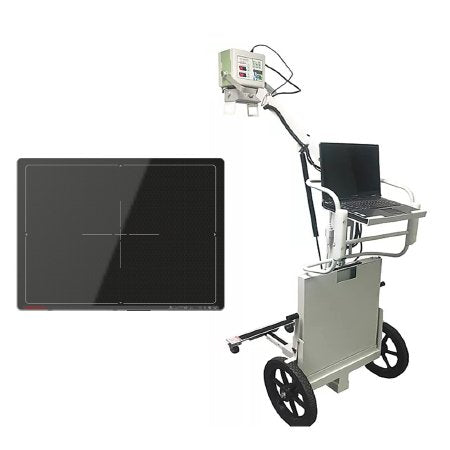 Rayence - DPX DR X-Ray System Portable with Panel 26 X 38-3/4 X 52-3/4 INch 100 lbs. Battery Operated - 001-0608-08-10