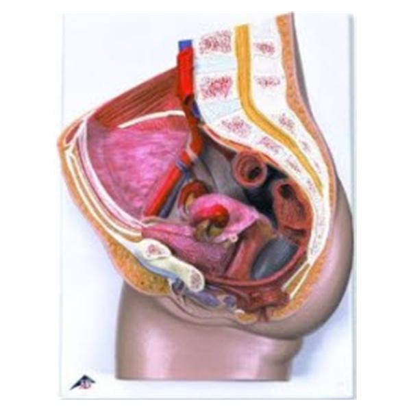Wolters Kluwer Health Inc Pelvis Section Model Anatomical Female Ea - H10