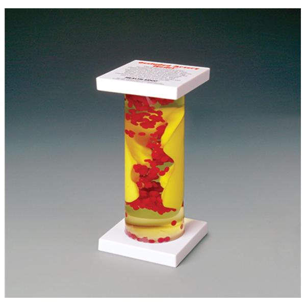 Wolters Kluwer Health Inc Occluded Artery Model Anatomical Ea - 79145