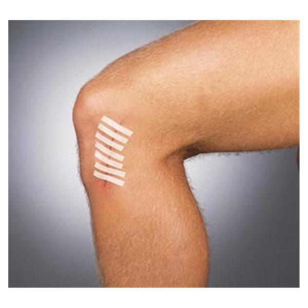 Integra LifeSciences Corp Strip Wound Closure Suture Strip 1/4X1-1/2" Water Resistant Neutral 6/Env 50/Bx - TS3104