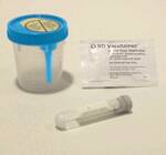 Becton Dickinson BD Vacutainer* Urine Specimen Collection Kit Sterile - 364989