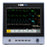 MDPro 6000 - Patient Monitor with CO2 Gas and Monitor Vitals Type 3/5 Lead ECG, NIBP, Pulse Rate, SpO2, Temperature AC Power / Battery Operated - Edan Usa - MDPRO6000.CO
