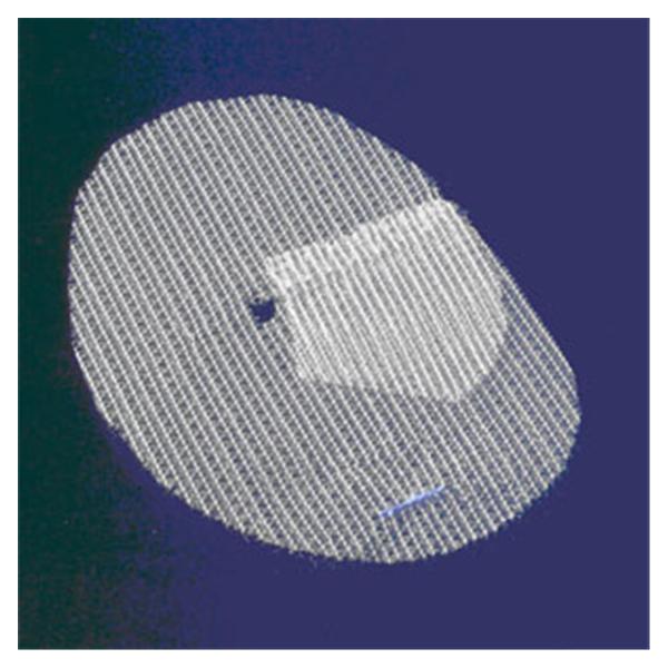 Medtronic MITG-Covidien Mesh Anatomical Parietex Progrip 12X8Cm Hernia With Flap Ea - TEM1208GR