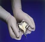 Bard-Parker SafetyLock Rib-Back - Surgical Blade Carbon Steel No. 22 Sterile Disposable Individually Wrapped - 371156