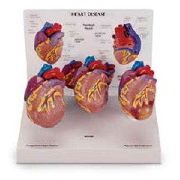 Nasco Company Mini Heart Model Anatomical 3/St - SB44893HR
